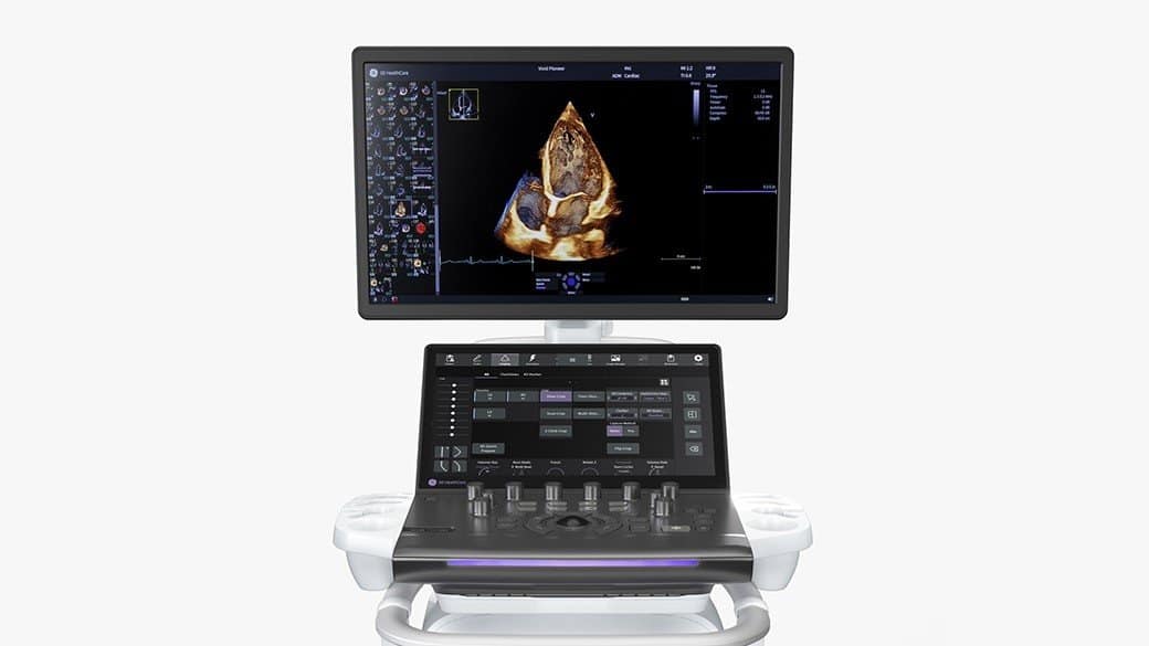 cardiac ultrason cardiac ultrason